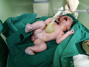 小孩吃瓜引产视频大全,揭秘小孩吃瓜引产视频背后的真相